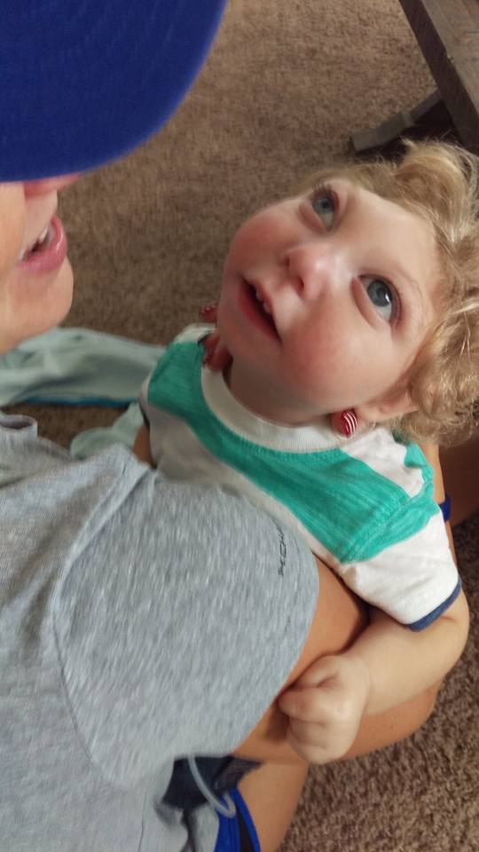 Así vive Jaxon, un niño con microcefalia