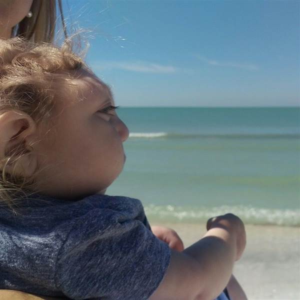 Así vive Jaxon, un niño con microcefalia