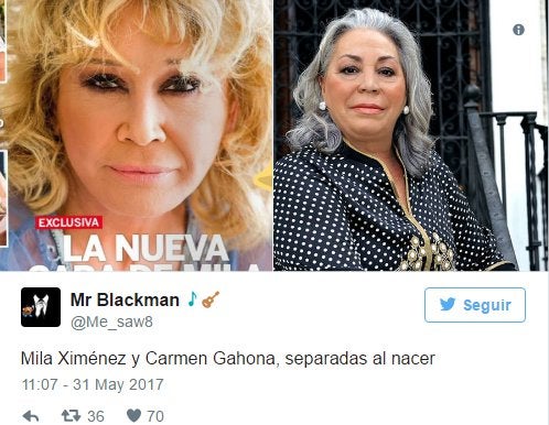 Los mejores &#039;memes&#039; de la nueva cara de Mila Ximénez