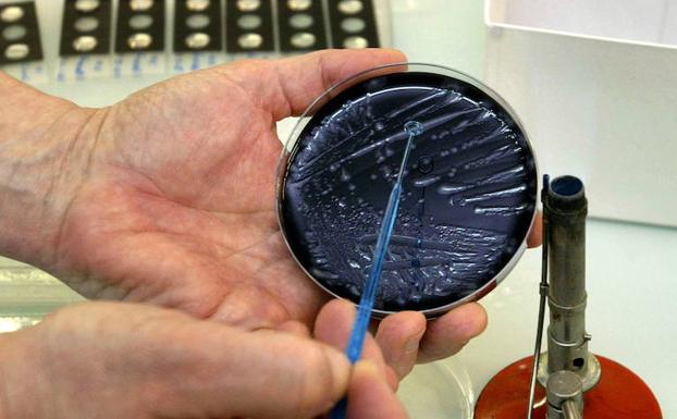 Un técnico de laboratorio sostiene una muestra de la bacteria Legionela.