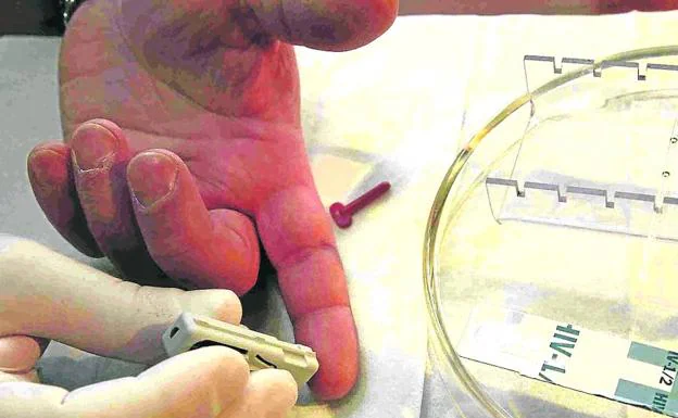 Un farmacéutico pincha el punzón de una prueba rápida del VIH a un paciente.