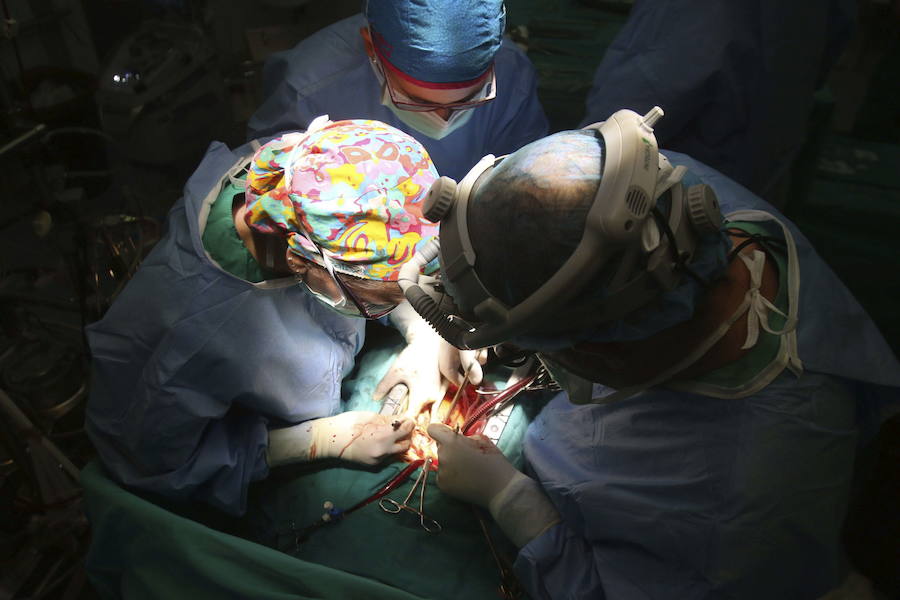 Cirujanos realizan un traslpante de corazón.