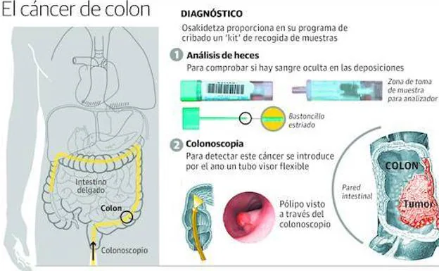 Los pasos a seguir.