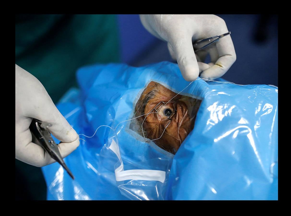 El Lifeline Express ha tratado a más de un millón de personas desde su creación, en 1991. Este tren de siete vagones, decorado con guirnaldas de flores, que atraviesa la India desde hace 27 años, se ha convertido en un verdadero hospital rodante para muchos miles de personas sin recursos. La mayor parte de los médicos son voluntarios de universidades u hospitales cercanos y, por lo general, pasan un mes en un distrito realizando cirugías que van desde cataratas y cáncer hasta hendiduras en el paladar y diversas ortopedias.