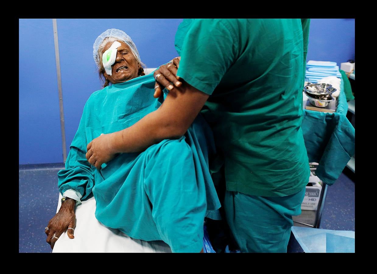 El Lifeline Express ha tratado a más de un millón de personas desde su creación, en 1991. Este tren de siete vagones, decorado con guirnaldas de flores, que atraviesa la India desde hace 27 años, se ha convertido en un verdadero hospital rodante para muchos miles de personas sin recursos. La mayor parte de los médicos son voluntarios de universidades u hospitales cercanos y, por lo general, pasan un mes en un distrito realizando cirugías que van desde cataratas y cáncer hasta hendiduras en el paladar y diversas ortopedias.