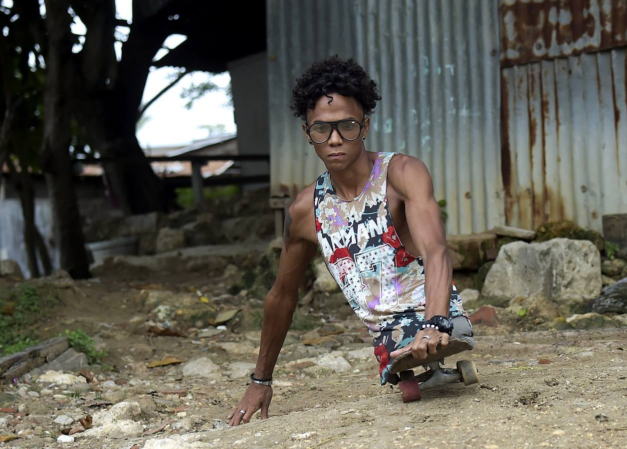 Alfonso Mendoza ha llegado muy lejos pese a su carencia. Surf, skate, charlas de motivación... Acaba de ser padre y se gana la vida cantando rap en los autobuses de Barranquilla.