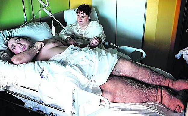 Nieves agarra la mano a su hermano José Miguel, que se recupera poco a poco en el hospital de Cruces.