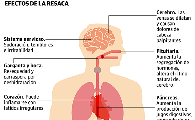Gráfico. Los efectos de la resaca.