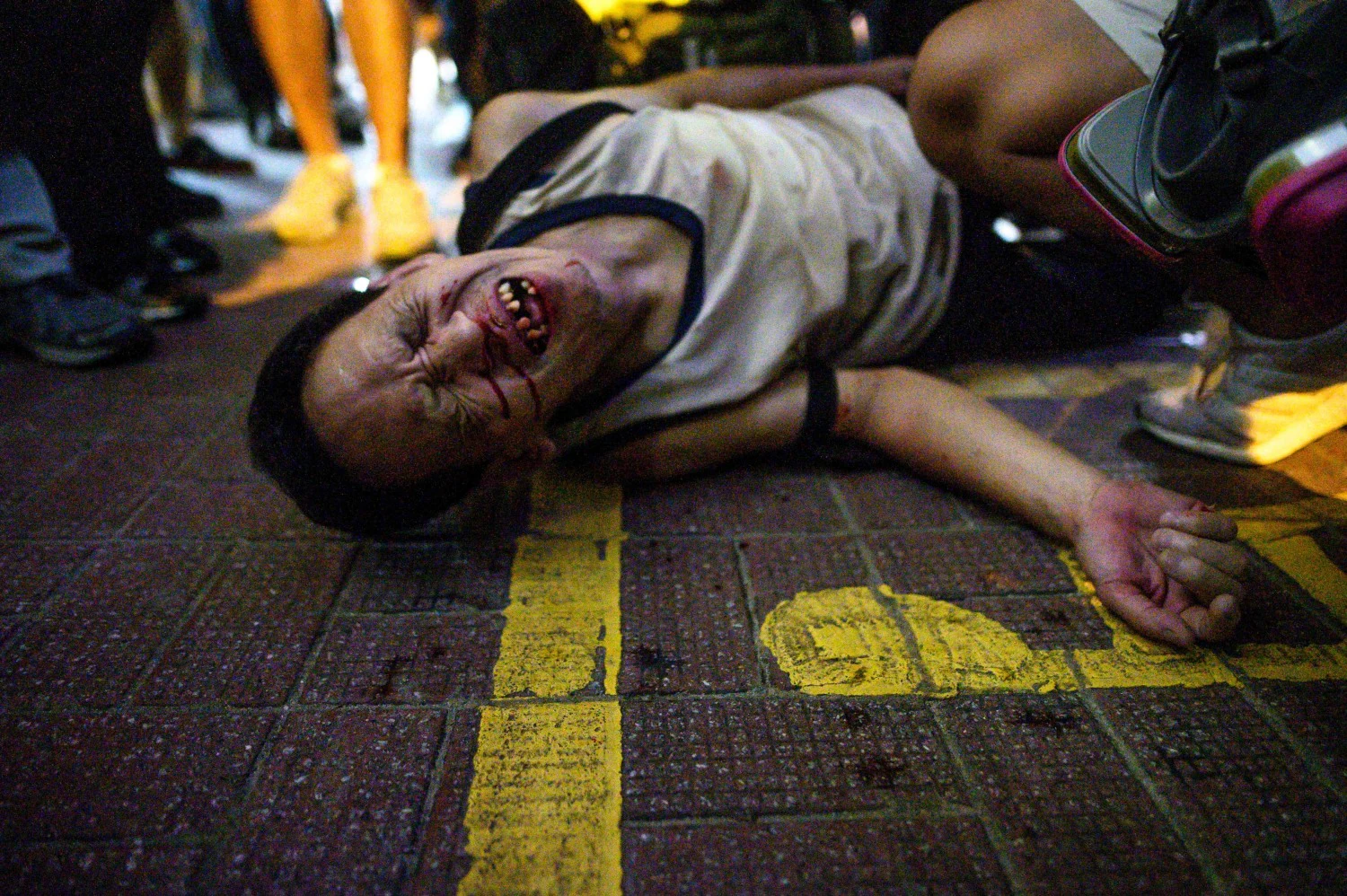 Un hombre no identificado reacciona después de ser golpeado por un grupo de personas después de una protesta en el distrito de Causeway Bay en Hong Kong .La policía antidisturbios de Hong Kong disparó gases lacrimógenos y cañones de agua contra manifestantes pro-democracia que arrojaban piedras y bombas de gasolina, volviendo la ciudad plagada de violencia al caos después de una breve pausa en los enfrentamientos. 