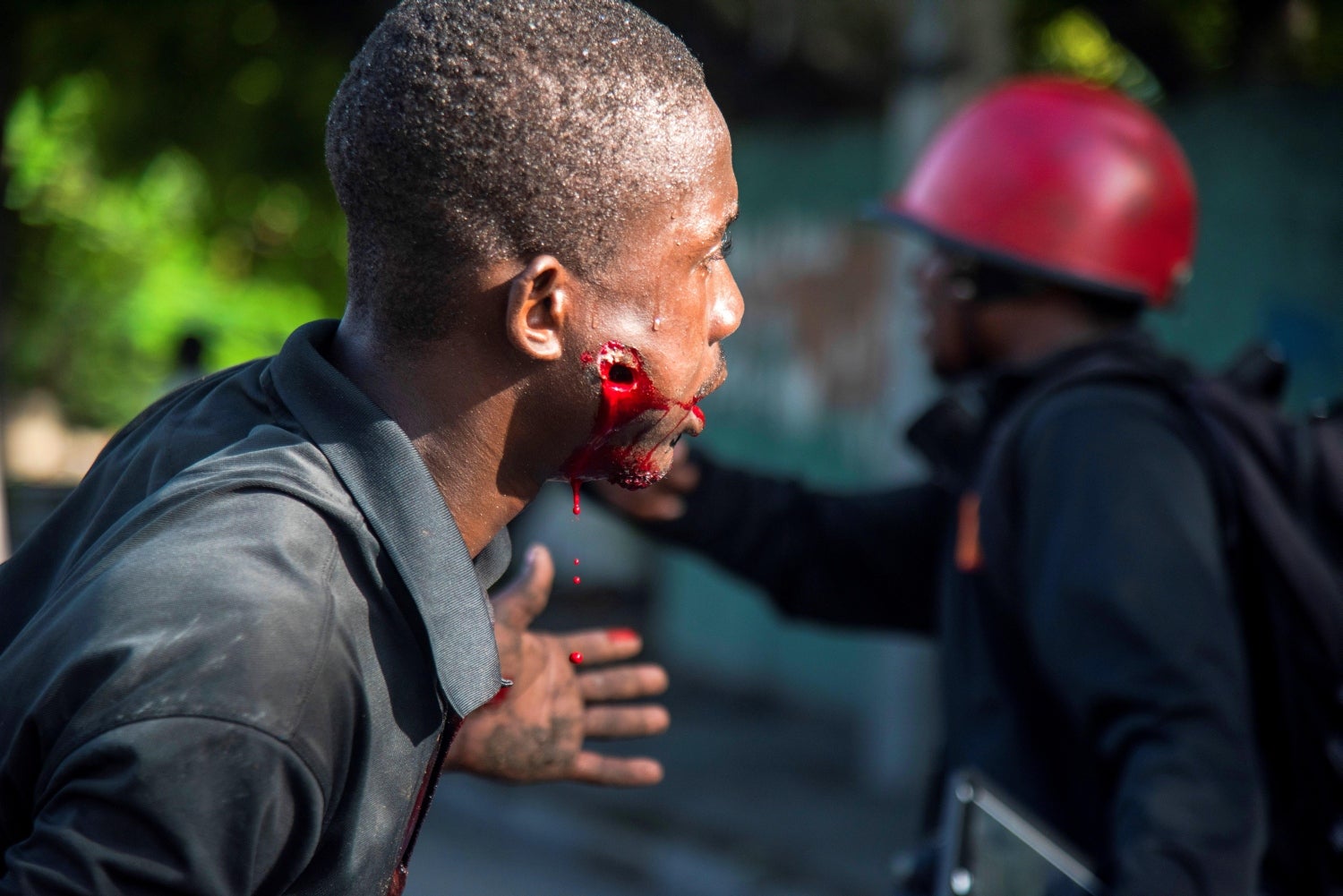 Joven herido por un disparo de la policía pide ayuda, en Puerto Principe (Haití). Miles de manifestantes volvieron a las calles de la capital de Haití para exigir la renuncia del presidente del país, Jovenel Moise, mientras líderes opositores convocaron a una movilización nacional el viernes próximo. 
