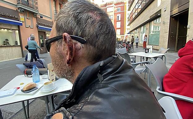 Varias heridas del ataque son perfectamente visibles.