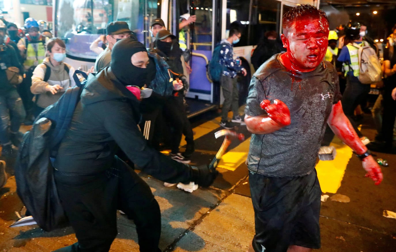 Hong Kong | Un hombre herido es atacado durante una protesta en el área de Mong Kok, el 11 de noviembre de 2019. 