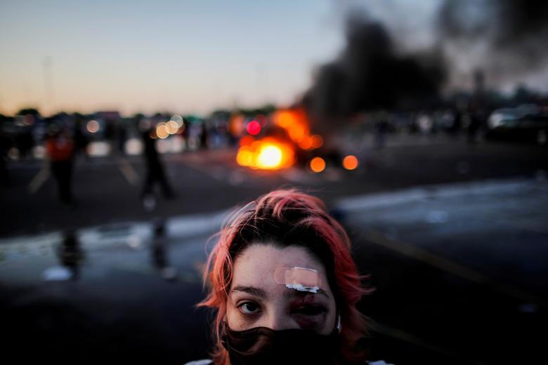 Rachel Pérez aparece en la foto con hematomas alrededor del ojo y una tirita en la frente, heridas sufridas por balas de goma durante las protestas de ayer, mientras está de pie a una distancia de un vehículo en llamas en el estacionamiento de una tienda Target mientras continúan las manifestaciones.