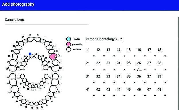 Tras realizar el perfil biológico, los datos de la muestra se incluyen en el software.