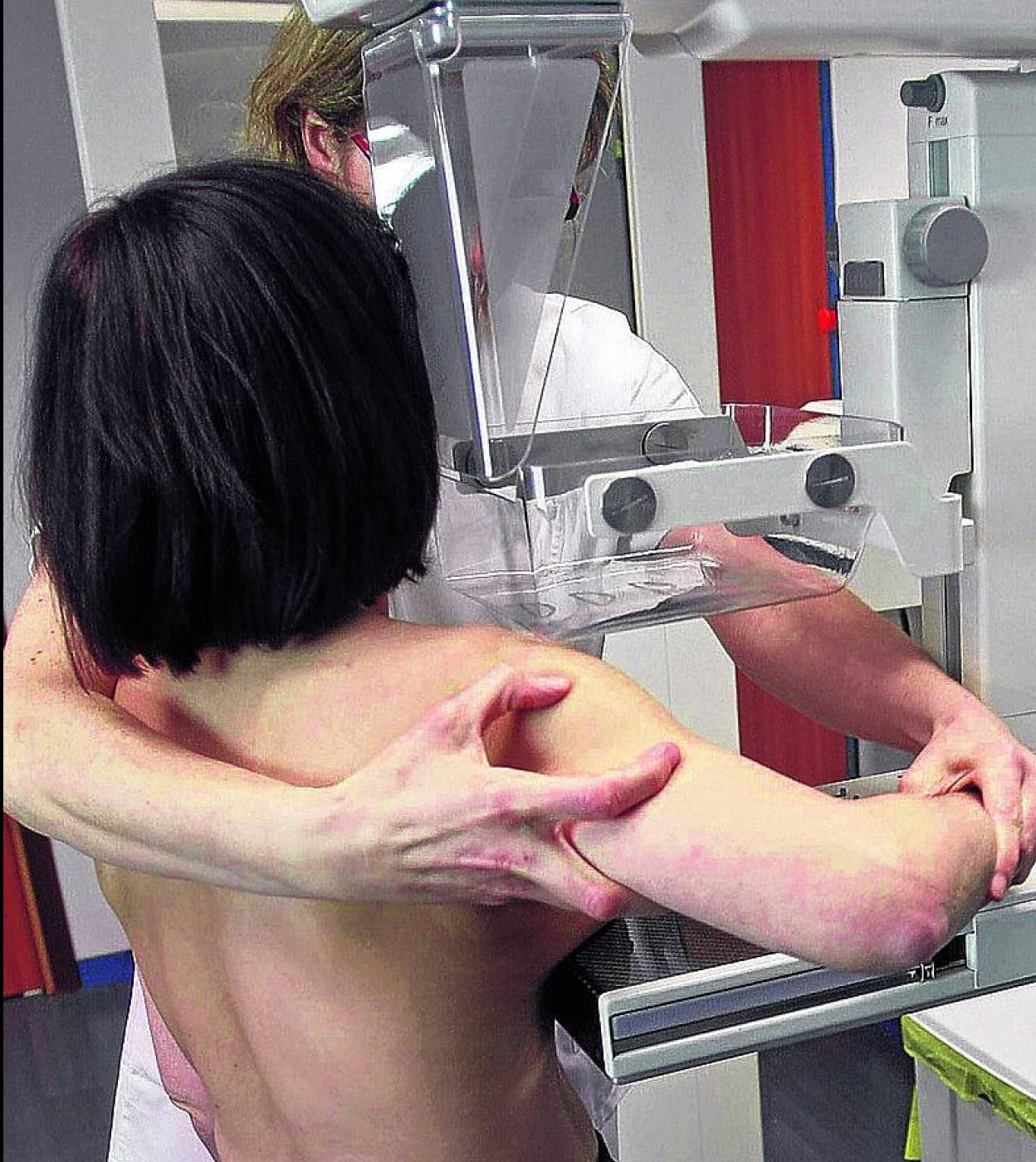 Las mujeres deben someterse a revisiones desde los 50 años.