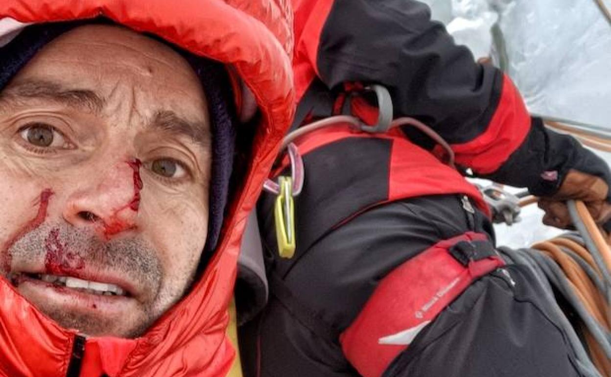 Eneko muestra las heridas que le dejó en la cara un trozo de hielo durante la apertura de 'Hanan Pacha'. 