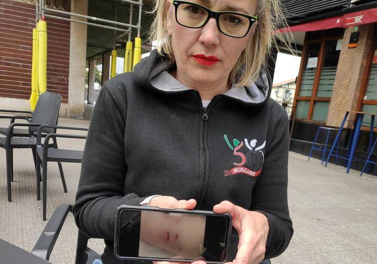 Victoria Eugenia Bustillo muestra una foto de las heridas que le causó un perro de raza Malinois.