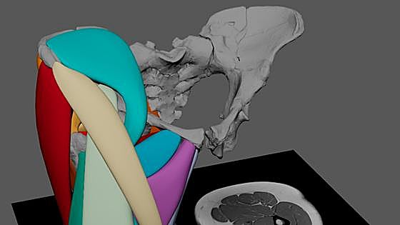 La reconstrucción muscular de los restos de Lucy, de hace 3,2 millones de años, demuestra que podía caminar como nosotros