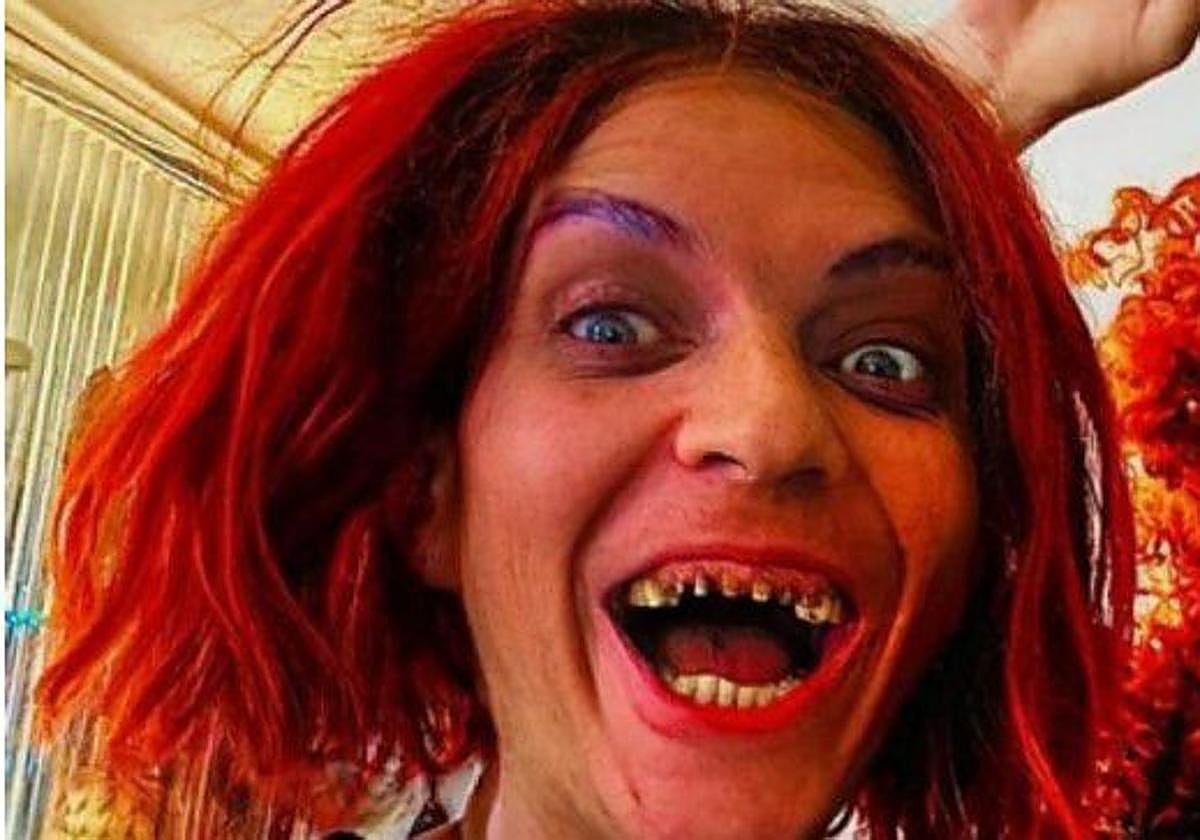 Camilín ingresará en un centro de rehabilitación