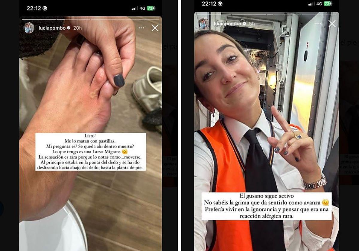 Lucía Pombo tiene un gusano dentro del pie: «Siento cómo crece y avanza»