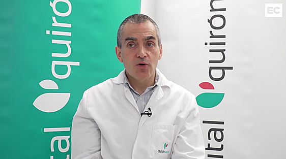 Cómo corregir la miopía, la hipermetropía y el astigmatismo