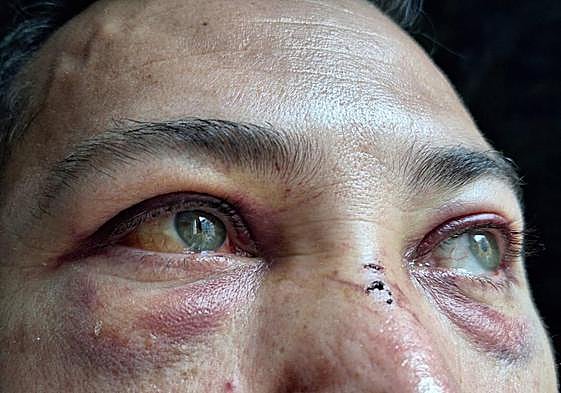 La víctima sufrió graves contusiones por todo el cuerpo y la cara.