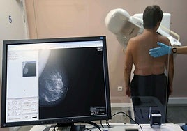 Médicos y pacientes piden ampliar las mamografías a mujeres hasta los 74 años