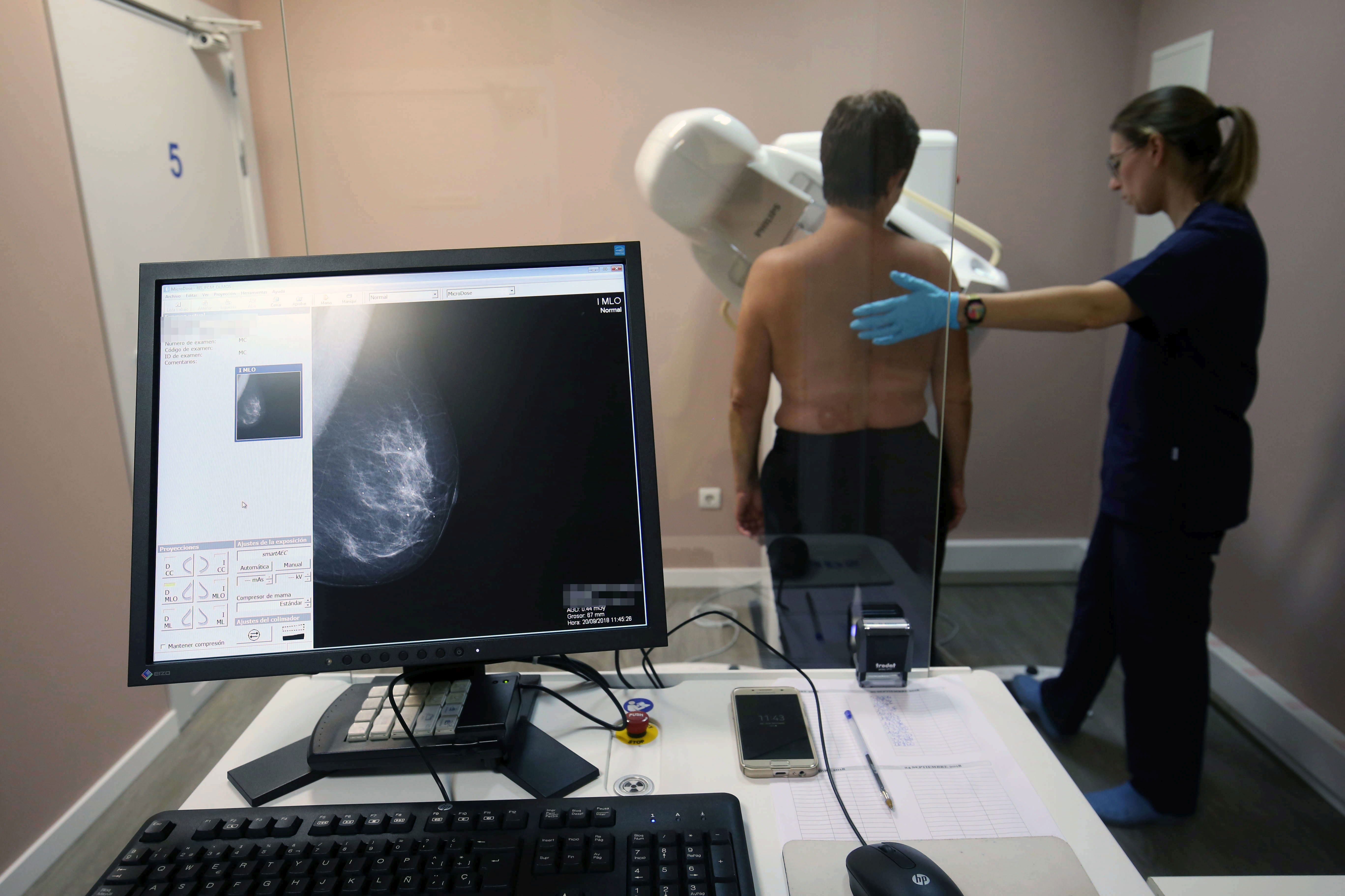 Médicos y pacientes piden ampliar las mamografías a mujeres hasta los 74 años