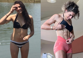 La influencer mexicana JousFit sufre un síncope tras inyectarse bótox en Dubai