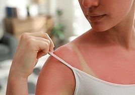 En qué consiste el callo solar, la «peligrosa tendencia» de la que advierte la OCU y que arrasa en TikTok