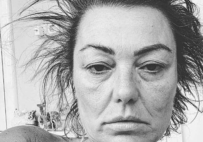 La impactante imagen que Amaia Montero publicó en octubre de 2022 visiblemente desmejorada.