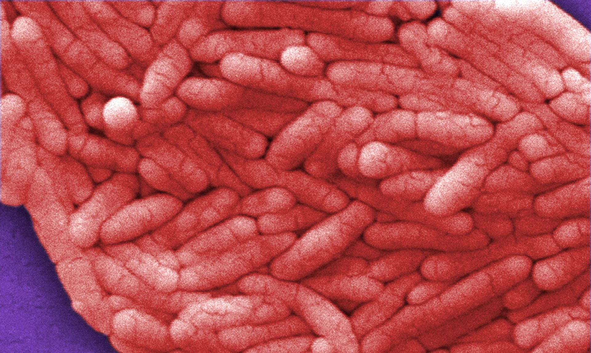 Salmonelosis, todas las claves de esta intoxicación alimentaria