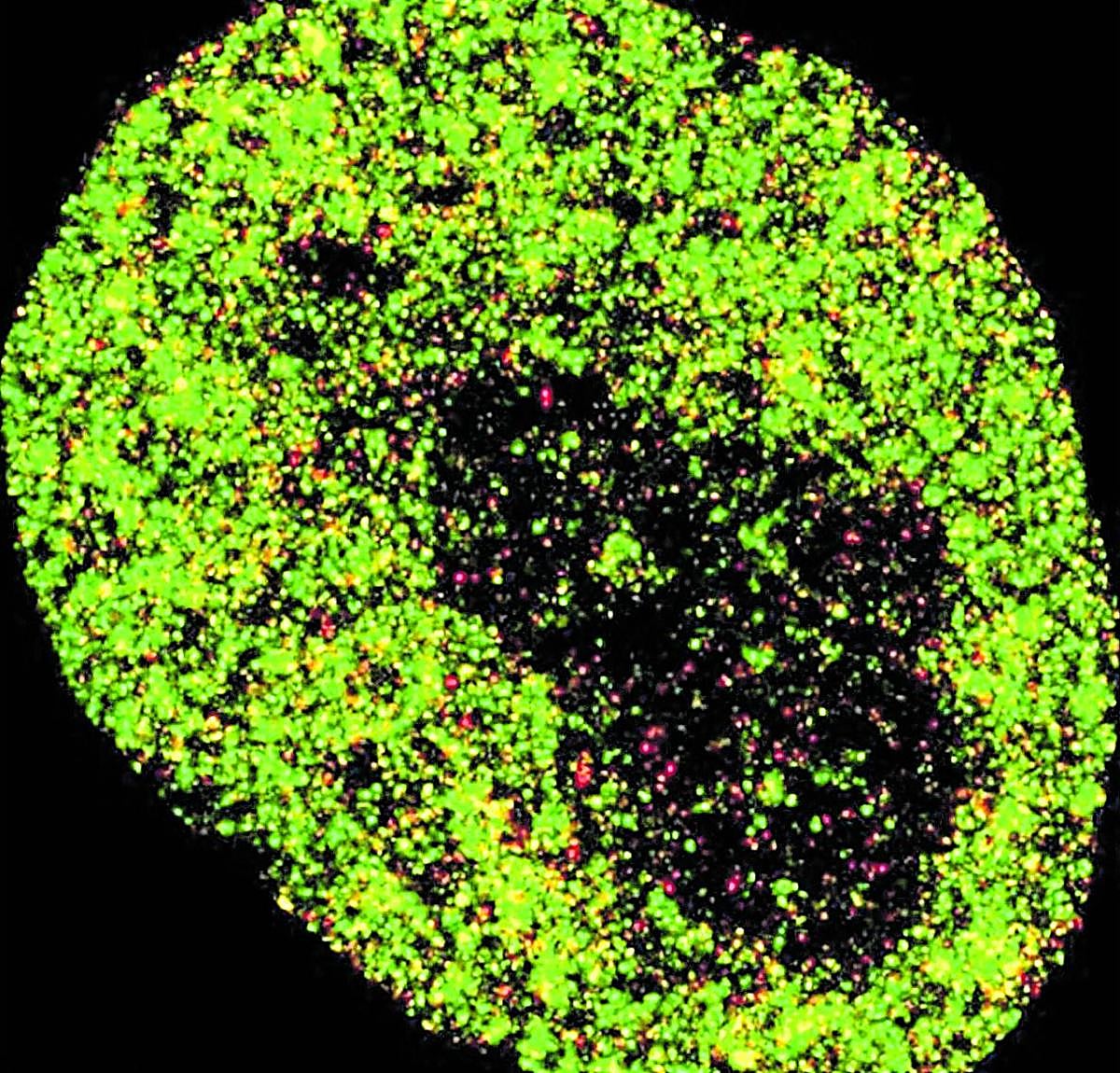 Imagen en superresolución de una célula cancerígena.