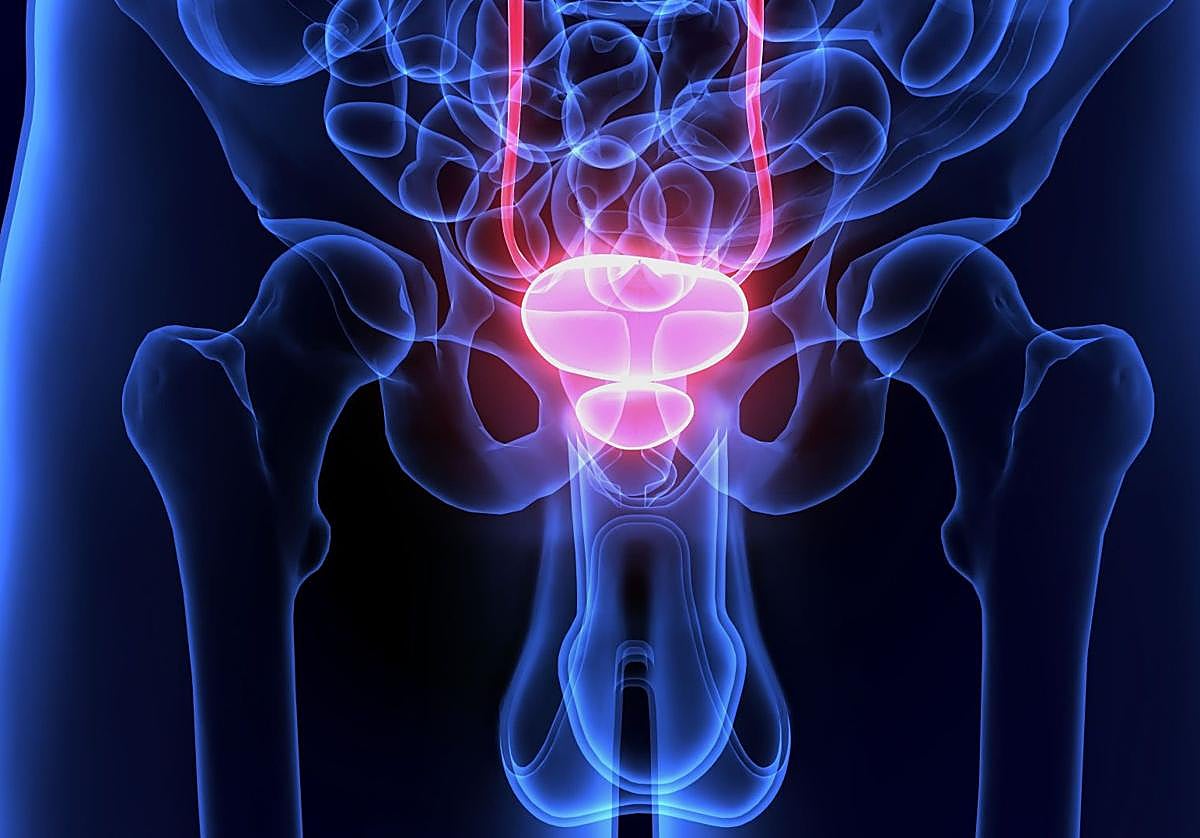 Euskadi se conjura contra el cáncer de próstata