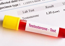 Los especialistas advierten de que este tratamiento requiere controles paralelos.