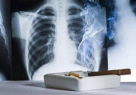 El 80% de los casos de cáncer de pulmón podría evitarse, porque están directamente provocados por el consumo, activo o pasivo, del tabaco.