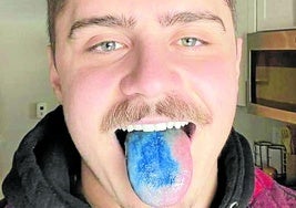 Un 'influencer' de las redes sociales muestra su lengua azul para demostrar a sus seguidores que consume azul de metileno.