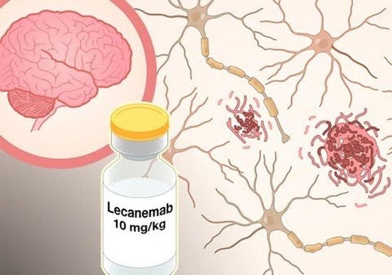 Primer fármaco contra el alzhéimer: de cómo el villano resultó ser héroe