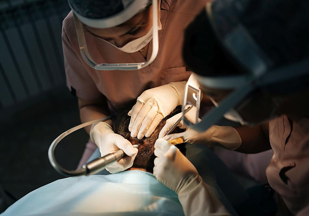 Un cirujano practica a un hombre un trasplante de cabello.
