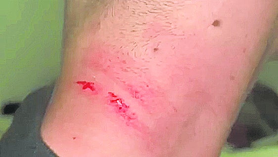 El padre que agredió a un menor de Durango dice que llevaba «una hora» molestando