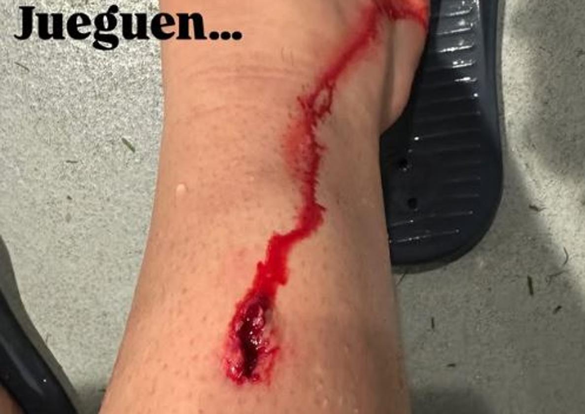 Prados muestra la herida sangrante por la dura entrada de Lindelof: «No hay falta, jueguen...»