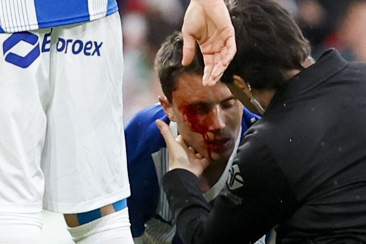 Las mejores fotos del Athletic-Alavés