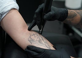 Proceso de eliminación de un tatuaje.
