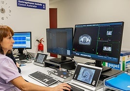 Basurto incorpora una nueva radioterapia que se adapta a los cambios en el tumor y en el paciente