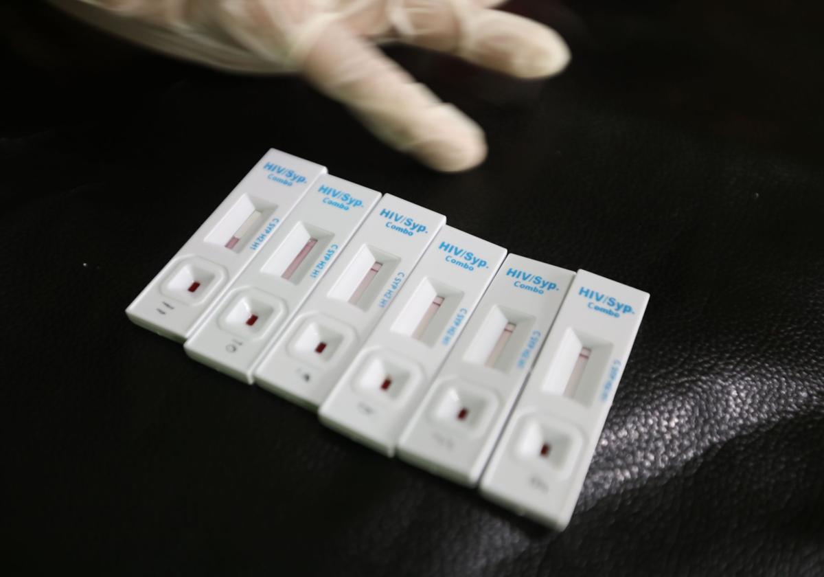 Cae un 60% el número de vascos que se hace un test rápido de VIH pese al aumento de los contagios