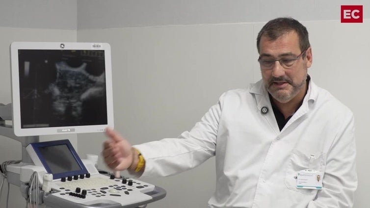 El doctor Carlos Emparan resuelve todas las dudas sobre las hernias abdominales