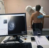 Un nuevo biomarcador predice qué pacientes no responderán a la quimioterapia