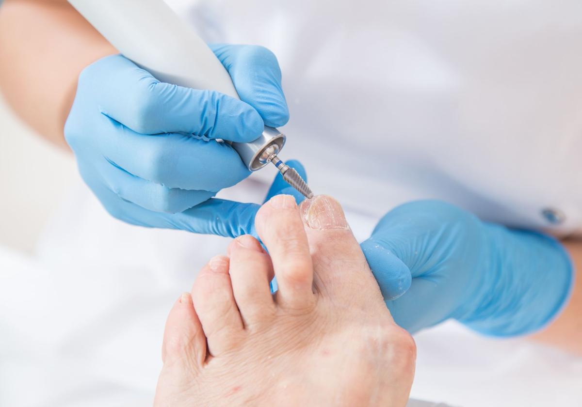 Un podólogo trata los pies de un paciente.