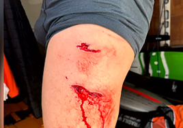 Herida producida por un tiburón a un bañista en Fuerteventura.