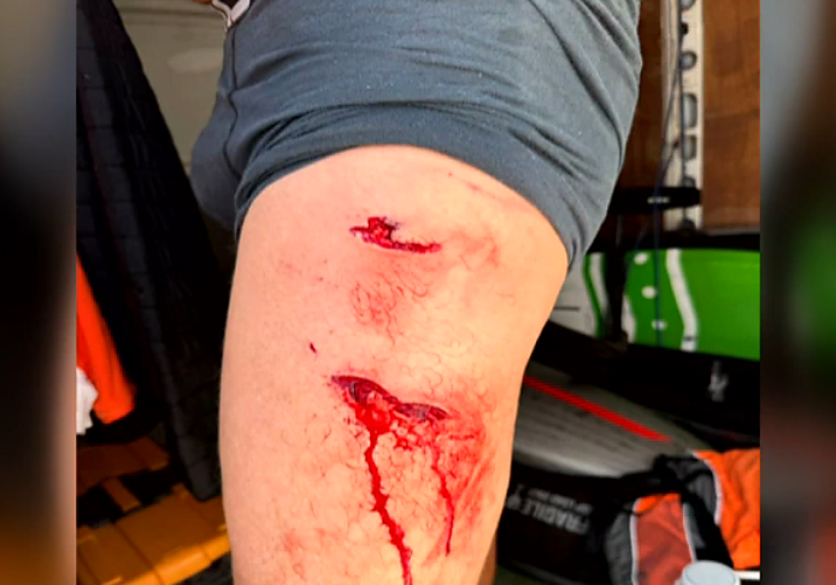 Herida producida por un tiburón a un bañista en Fuerteventura.